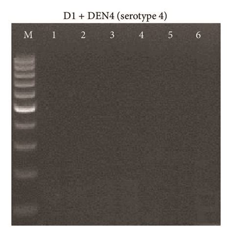 Identification of dengue virus serotypes by the specific primers. Four ...