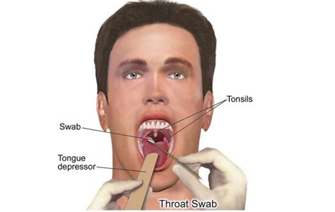 Sore Throat Allergies - A Health Tutor