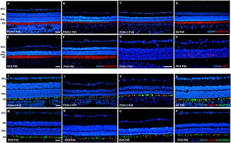 Frontiers | Early Events in Retinal Degeneration Caused by Rhodopsin Mutation or Pigment ...