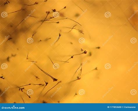 Aspergillus Fumigatus, Microscope View of the Mycelium Stock Photo ...