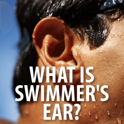 The Doctors: What Is Seabather's Eruption? Treatment For Swimmer's Ear