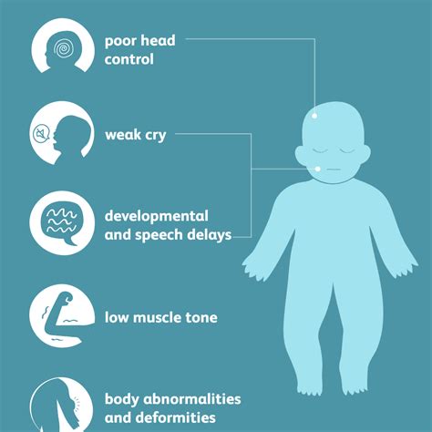 Phelan-McDermid Syndrome: Symptoms, Causes, Diagnosis, Treatment, and ...