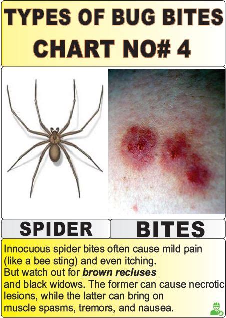 Spider Bite Chart