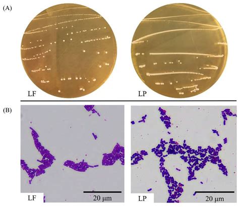 Lactobacillus Diagram