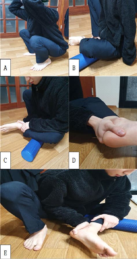 Table 1 from Effect of Peroneus Longus Muscle Release on Abductor Hallucis Muscle Activity and ...