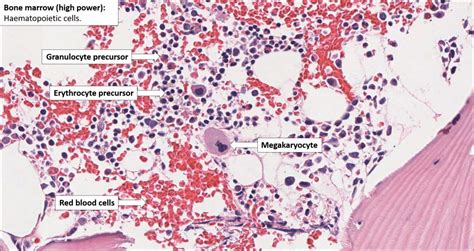 Bone Marrow – Normal Histology – NUS Pathweb :: NUS Pathweb