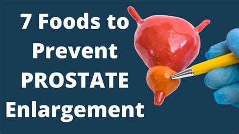 Eat These 7 Foods to Prevent Prostate Enlargement | VisitJoy - YouTube