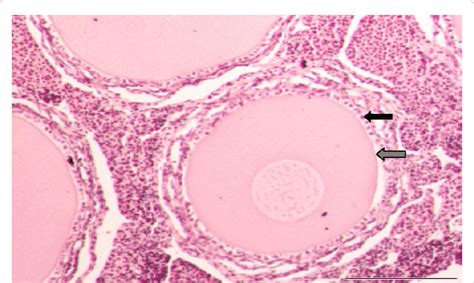 Light microscopy image of an ovarian follicle. The black arrow ...