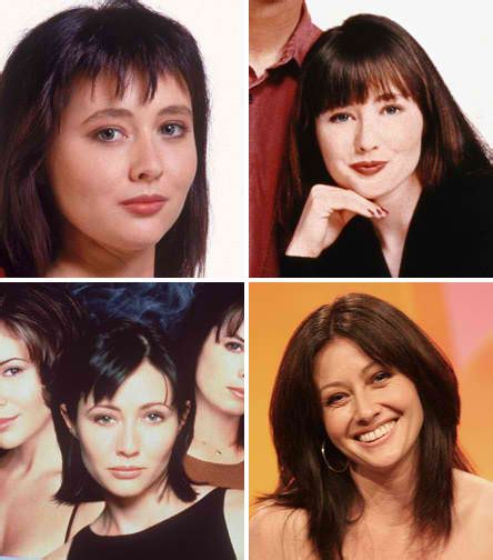 Shannen Doherty Plastic Surgery