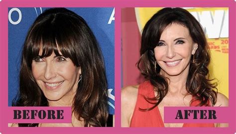 Mary Steenburgen Plastic Surgery - Has Brought Her Sexy Back