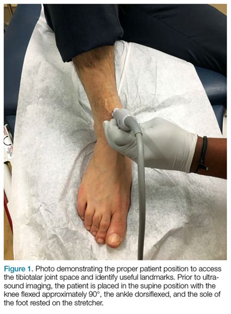 Emergency Ultrasound: Ultrasound-Guided Arthrocentesis of the Ankle | MDedge Emergency Medicine