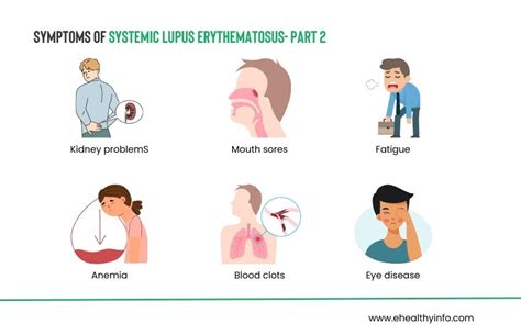 What Do Lupus Mouth Sores Look Like - Infoupdate.org