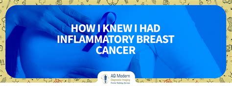 How I Knew I Had Inflammatory Breast Cancer - AQMDI Blogs