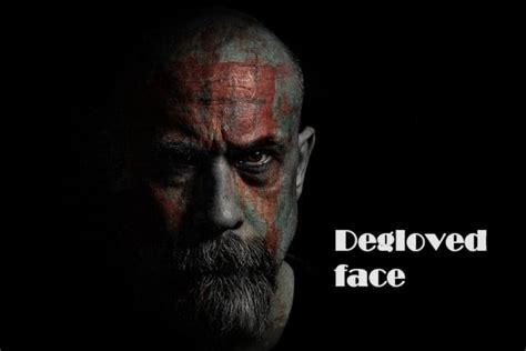 Degloved Face | A Comprehensive Guide About This Severe Injury - vofey-shop