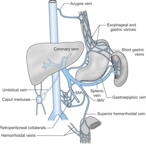 Coronary Vein Portal Hypertension