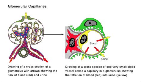 Glomerular Disease | UNC Kidney Center