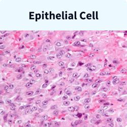 Mesothelioma Cells: The Three Major Mesothelioma Cell Types