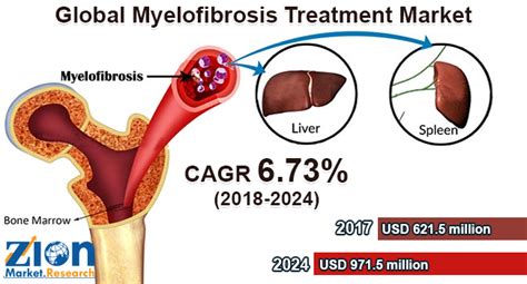 Myelofibrosis Treatment Market Size, Share, Trends and Forecast 2032