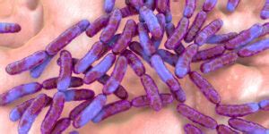 Lactobacillus Helveticus: Benefits And Side-Effects - Probiotics Advice