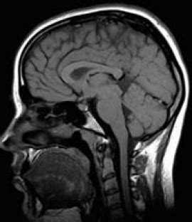 Types of Magnetic Resonance Imaging (MRI) Exams | Stanford Health Care