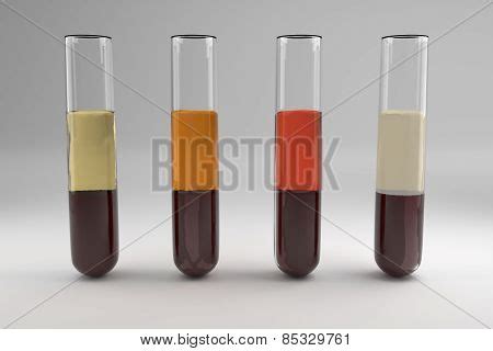 Blood Serum Common Image & Photo (Free Trial) | Bigstock