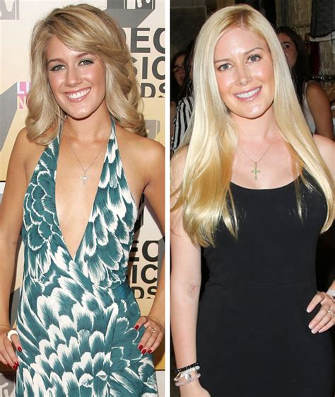 Heidi Montag on Her Plastic Surgery Past: "I Became Consumed by This ...