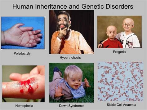 Human Inheritance & Genetic Disorders | PPT