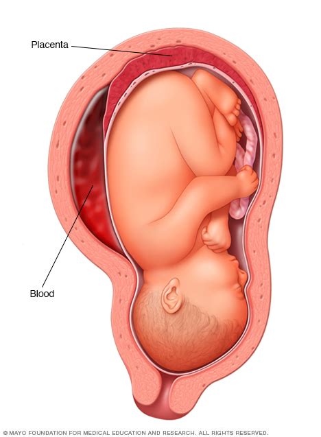 Placenta: How it works, what's normal - Mayo Clinic