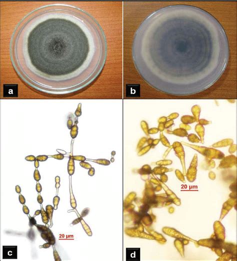 Alternaria alternata: a, Top view of colony on PDA. b, Reverse view of... | Download Scientific ...