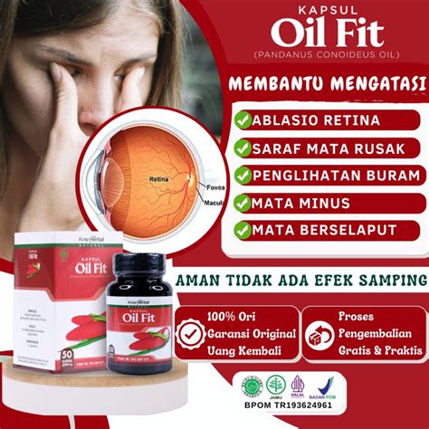 Jual Obat Ablasio Retina Saraf Mata Rusak Lemah Mata Penglihatan Buram ...