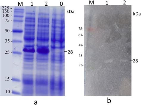 (a) SDS PAGE of recombinant cells lysate and (b) zymogram stained with ...