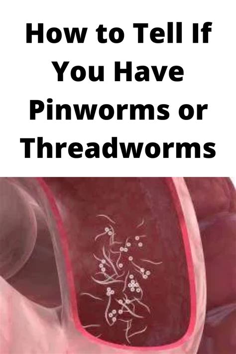 How to Tell If You Have Pinworms or Threadworms | How to treat pinworms ...