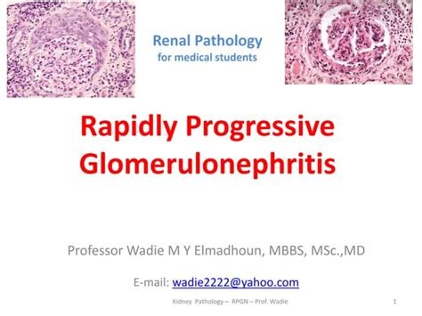 RPGN Types Pathology | PPT