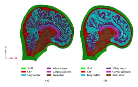 The development process of the models with and without gyri and sulci ...