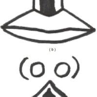 The Philtrum Classification (Mori et al. 2005) | Download Scientific ...