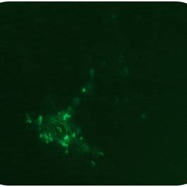 Macrophage Phagocytosis Assay