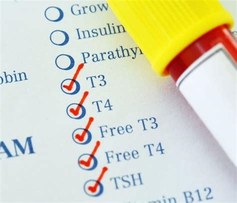 How Often Should a Thyroid Test Be Carried Out? - Forth