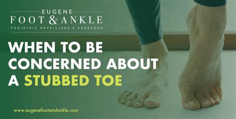 A Stubbed Toe is Treatable | Eugene Foot & Ankle