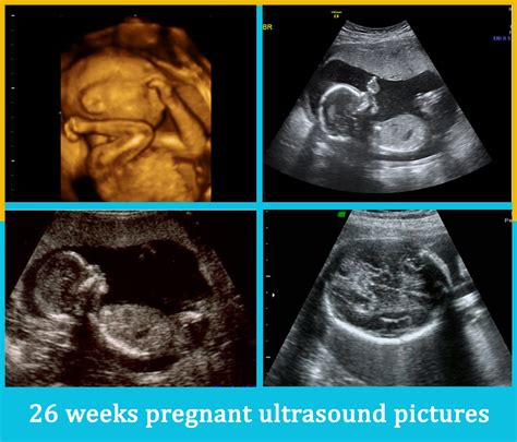 26 Weeks Pregnant Ultrasound Pictures - PREGNANTSH