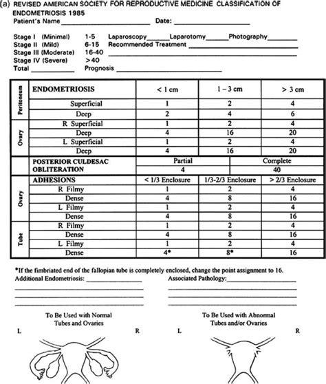 Classification of Endometriosis - Indian Center for Endometriosis (ICE)