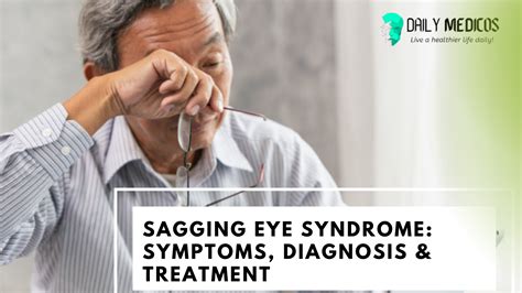 Sagging Eye Syndrome: Causes, Symptoms, Diagnosis & Treatment - Daily ...