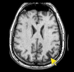 Harvard MRI Flashcards | Quizlet