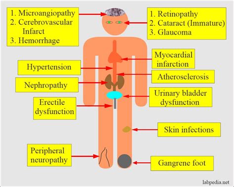 Diabetes mellitus complications and management