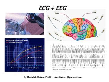 PPT – ECG EEG PowerPoint presentation | free to view - id: 6ba34-ZDc1Z