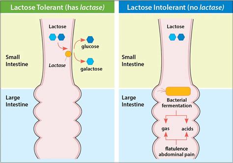 Various Sources Of Calcium For Lactose Intolerant Children, Causes, Types and Symptoms