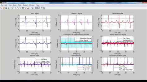 Signals and Systems Matlab Projects | Signals and Systems Matlab Thesis - YouTube