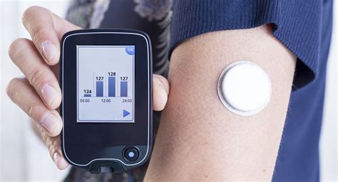 Abbott, Tandem Diabetes Care partner to integrate tech for automated ...