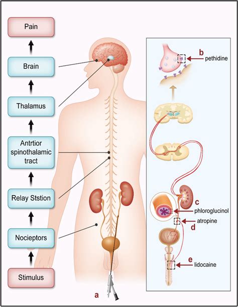 Nociceptors perceive the surgical stimulus and then upload the signal ...