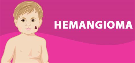 Hemangioma – Causes, Symptoms, Diagnosis, And Treatment – HealthInfoNetwork