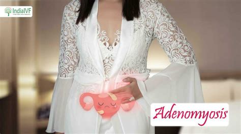 What Is Adenomyosis: Symptoms, Causes and Treatments?